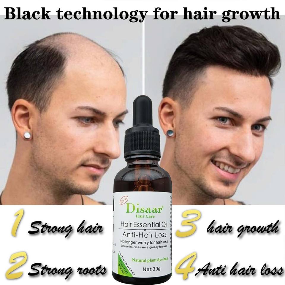 Reparação do folículo capilar Crescimento capilar Óleo de essência de plantas