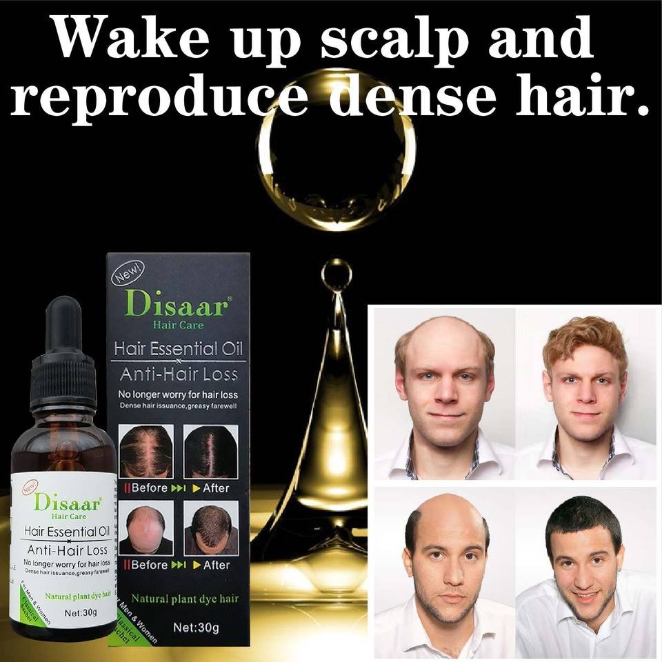 Reparação do folículo capilar Crescimento capilar Óleo de essência de plantas - Imagem 5